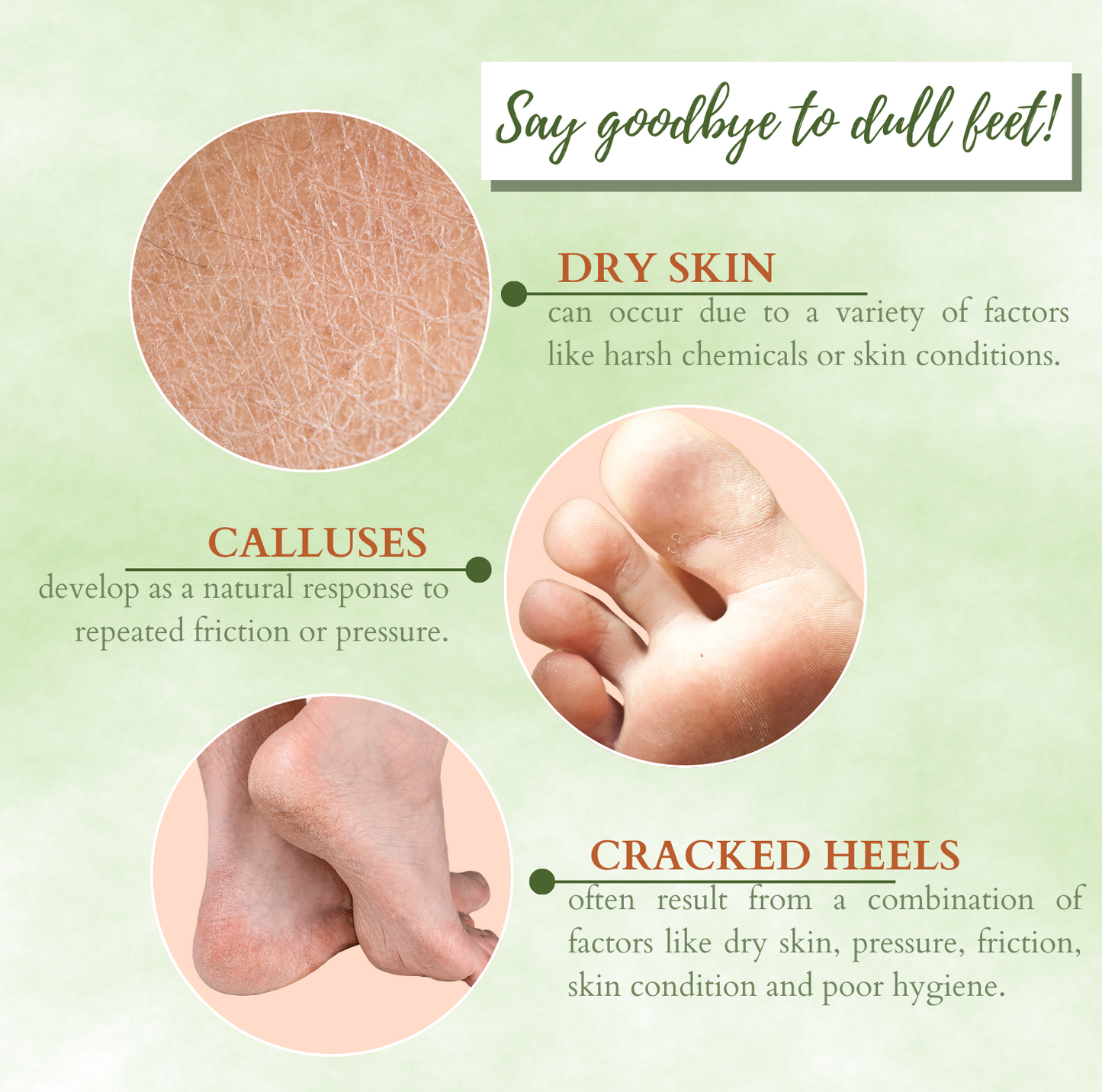 Infographic showing common foot care concerns including dry skin, calluses and cracked heels that benefit from exfoliating and moisturising foot treatments